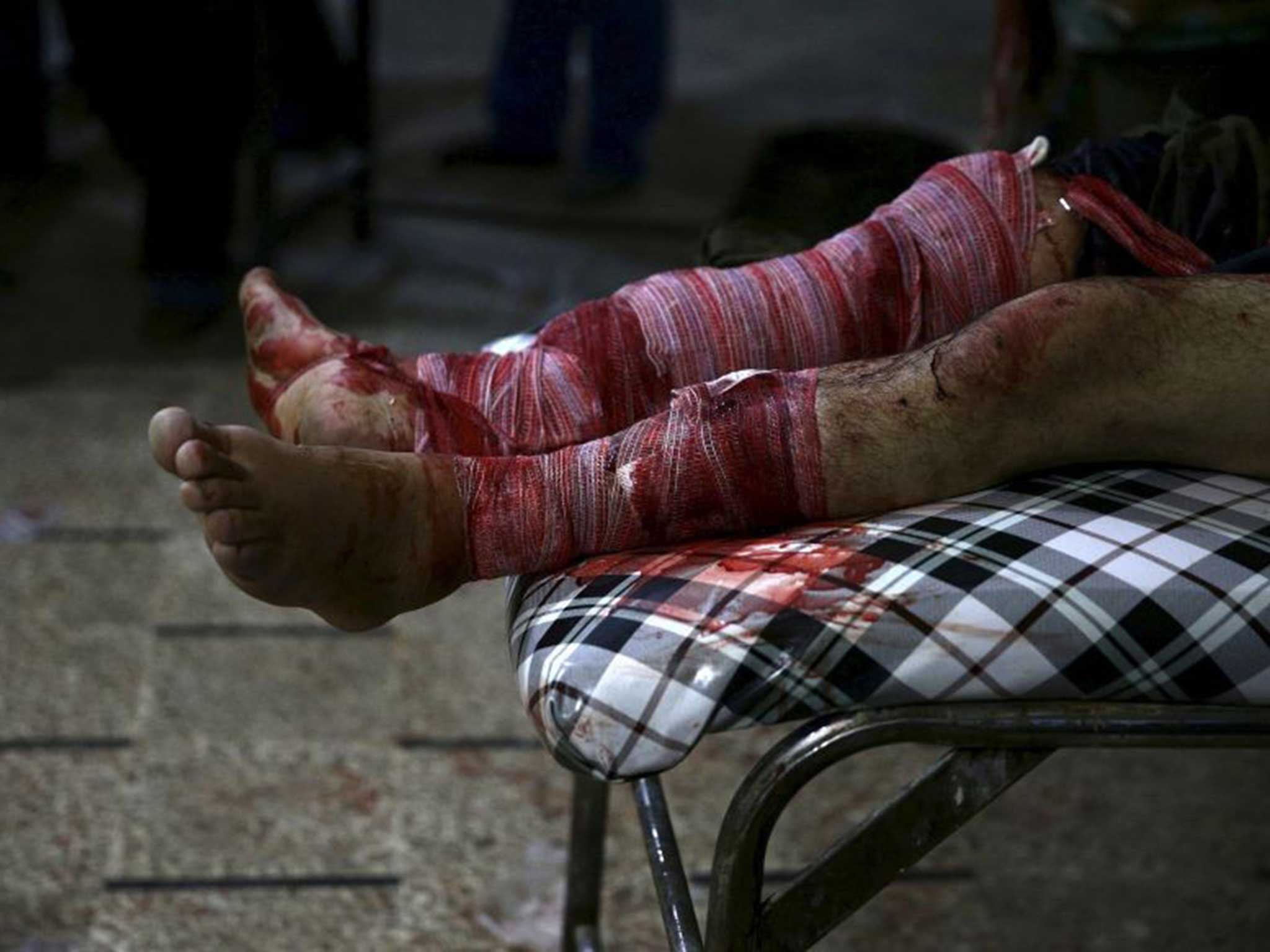 An injured man lies in a field hospital in Douma, a neighbourhood of Damascus