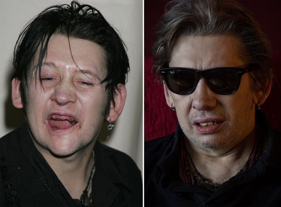 Shane MacGowan in 2005 (left) and now