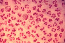 Gonorrhoea could become 'untreatable'
