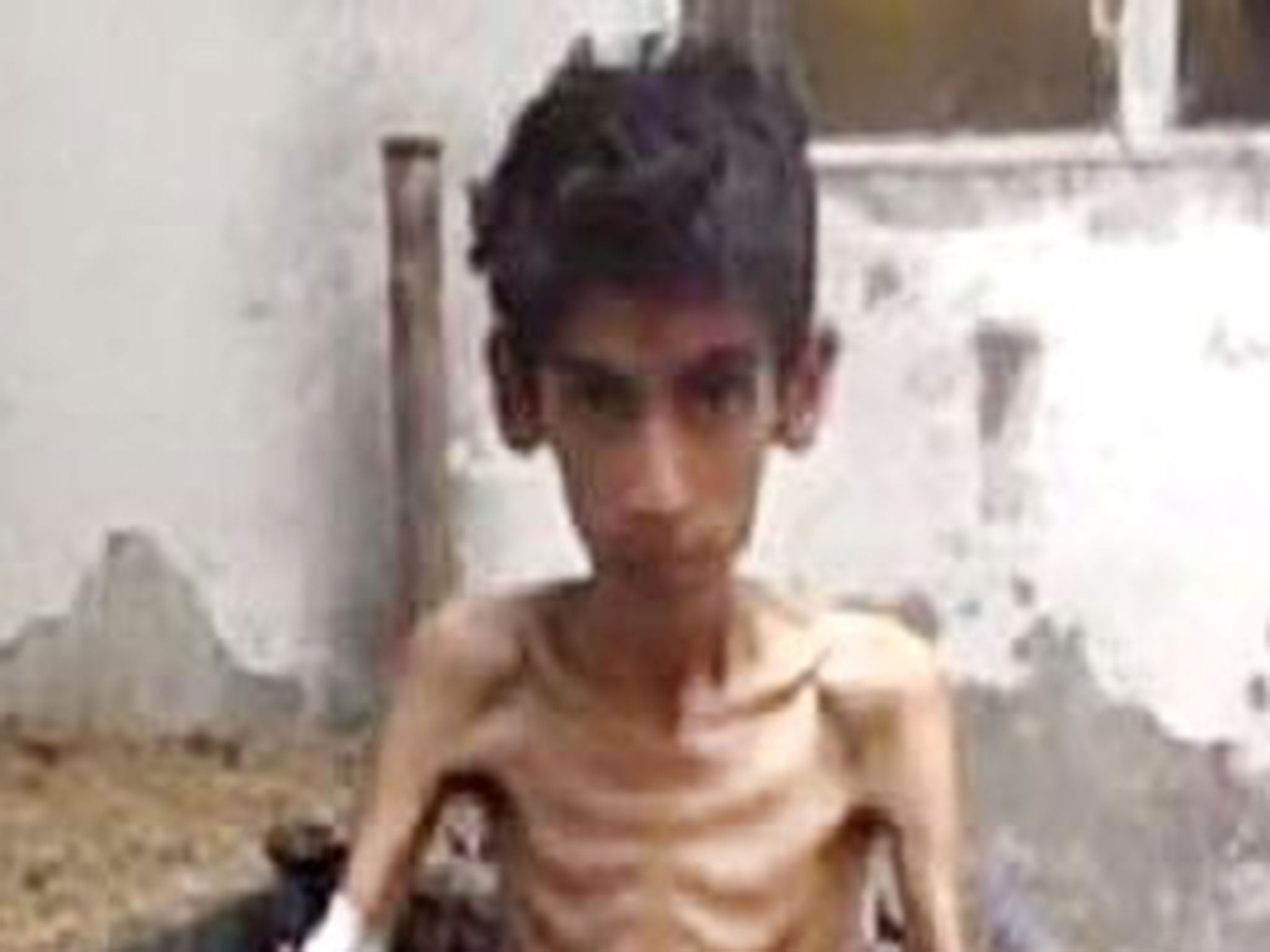 A starving boy is seen in a picture released by the Local Revolutionary Council in Madaya