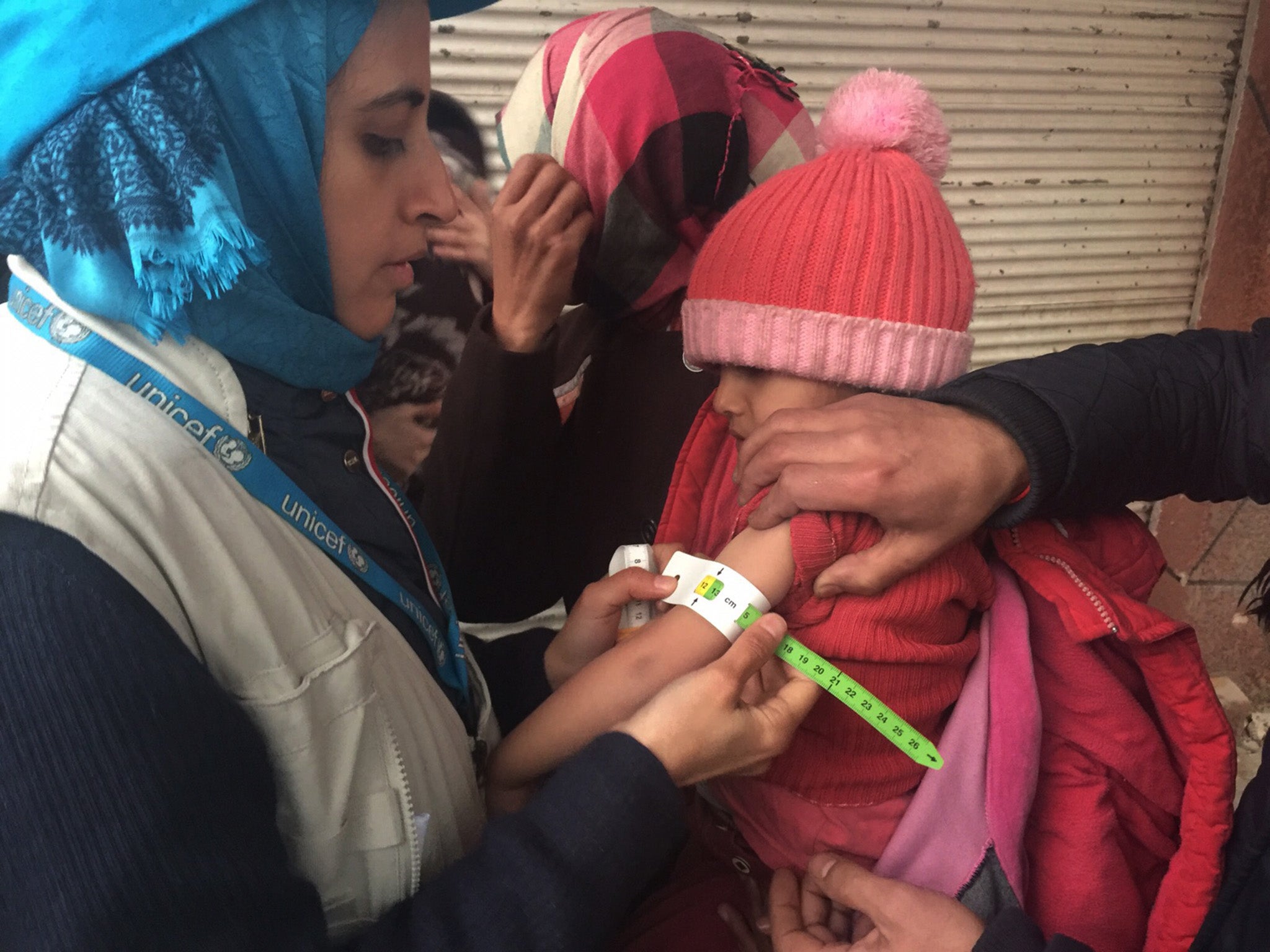 UNICEF employee measuring the arm of a malnourished child in the besieged Syrian town of Madaya, as they assess the health situation of residents of the famine-stricken town.
