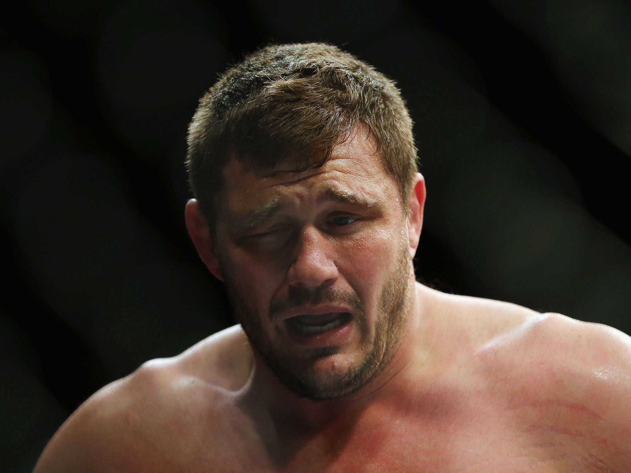 Matt Mitrione's right eye begins to swell at the end of the first round