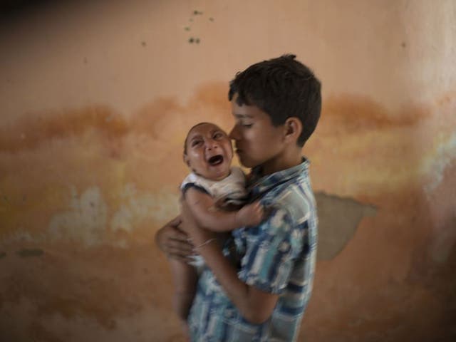 A baby with microcephaly cries in Brazil 