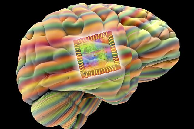 (FILE IMAGE) The device could be implanted into the brain without the need to remove it once its job is done