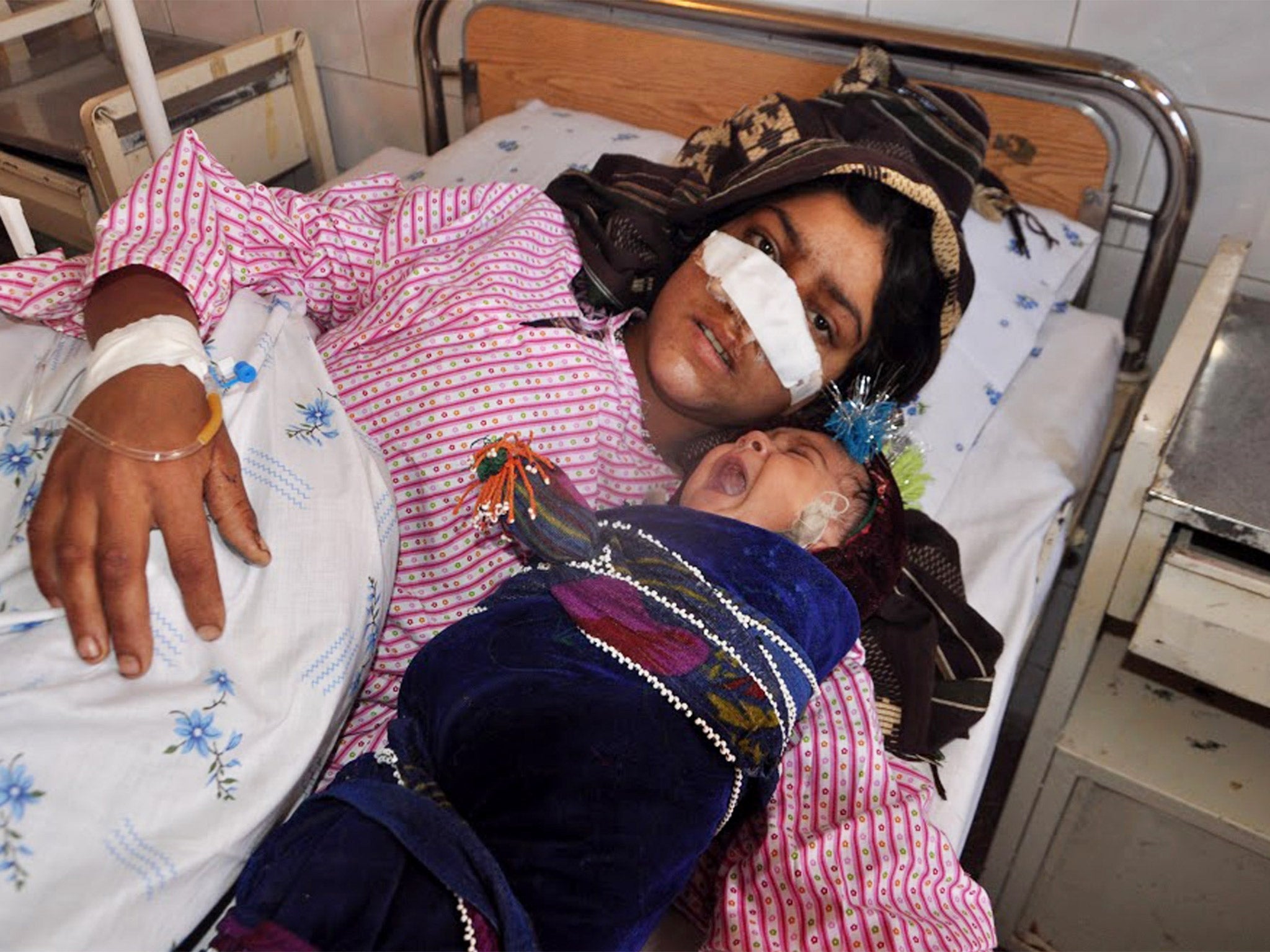 Reza Gul, whose nose was sliced off by her husband, lies on a bed with her baby as she receives treatment at a hospital in the northern province of Faryab