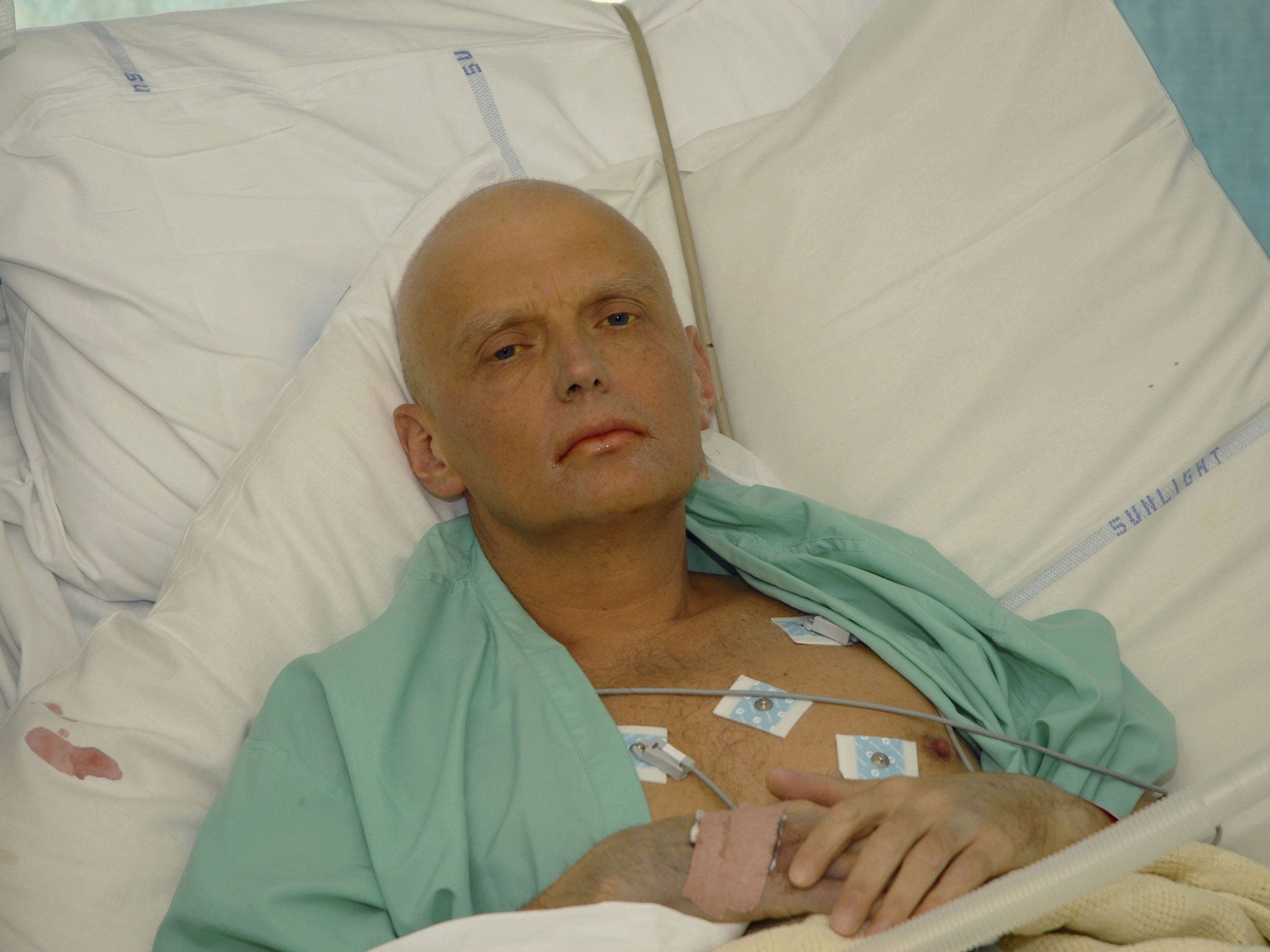 Alexander Litvinenko in the intensive care unit of University College Hospital in London