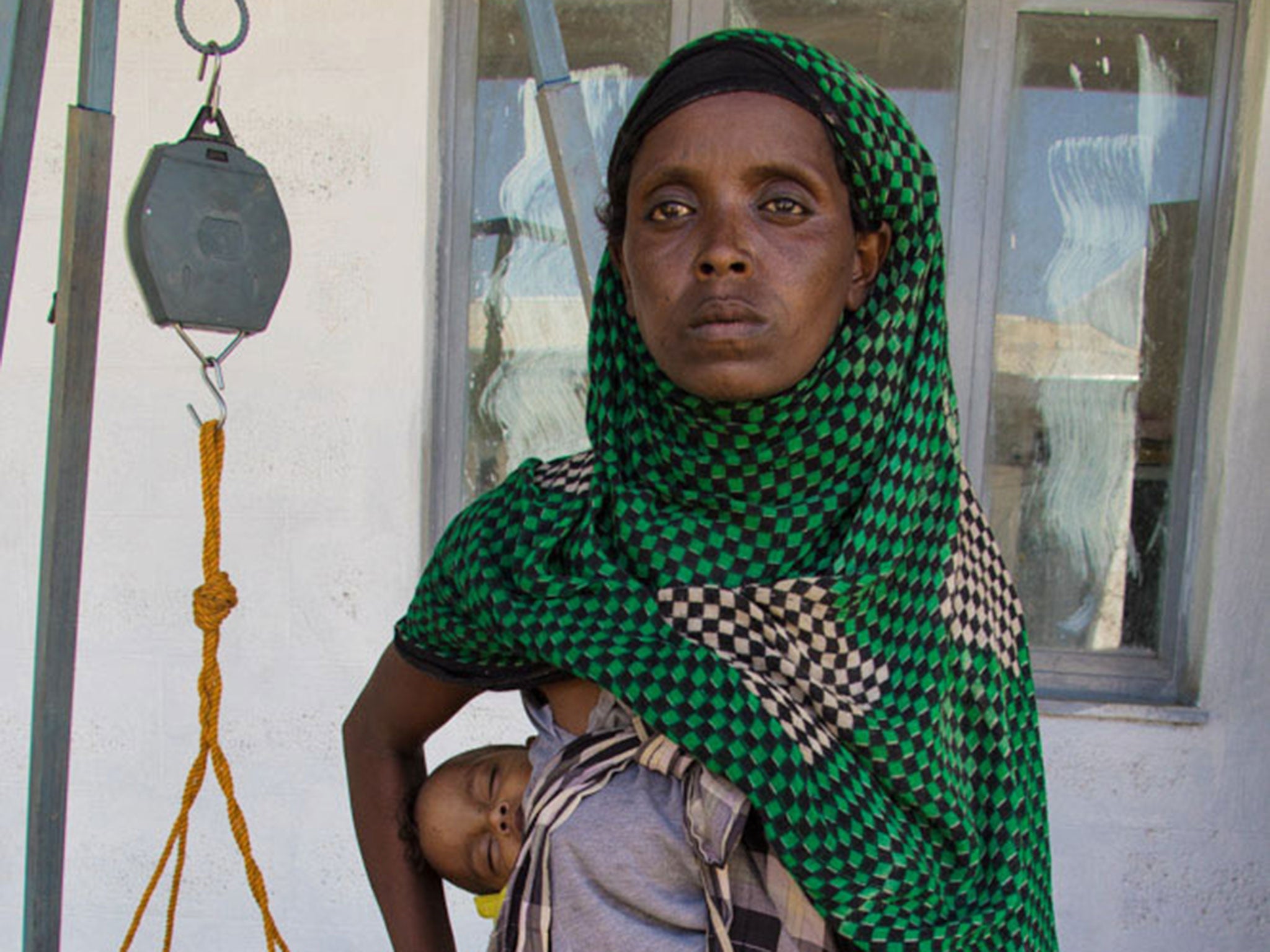 A mother seeks treatment for her malnourished baby at Save the Children’s Mender centre