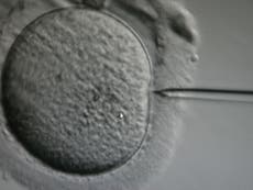IVF procedure 'that makes older eggs young again' could come to UK