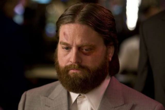 Zach Galifianakis as Alan in 2009's The Hangover