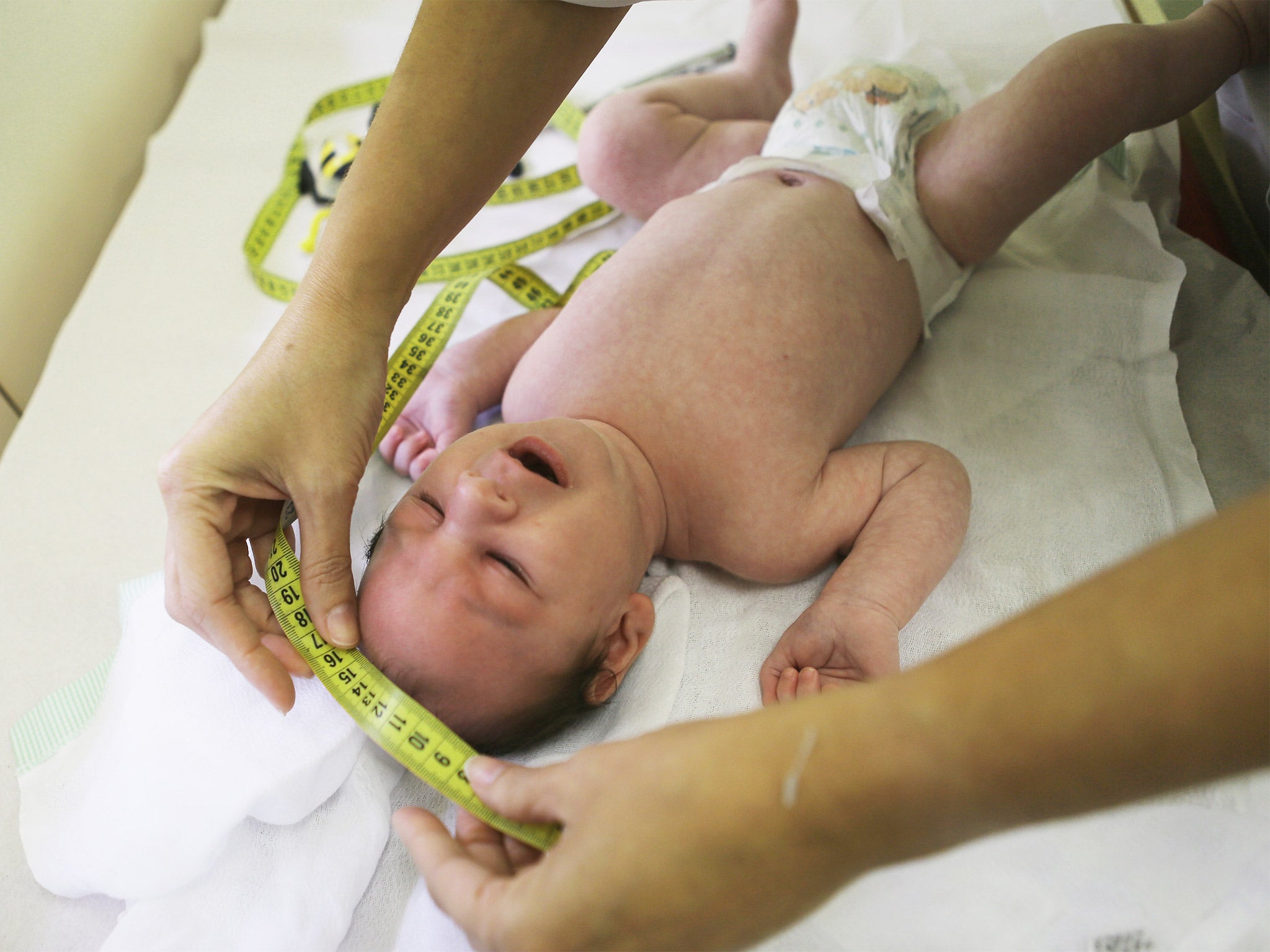 A doctor measures the head of a baby with microcephaly in Brazil