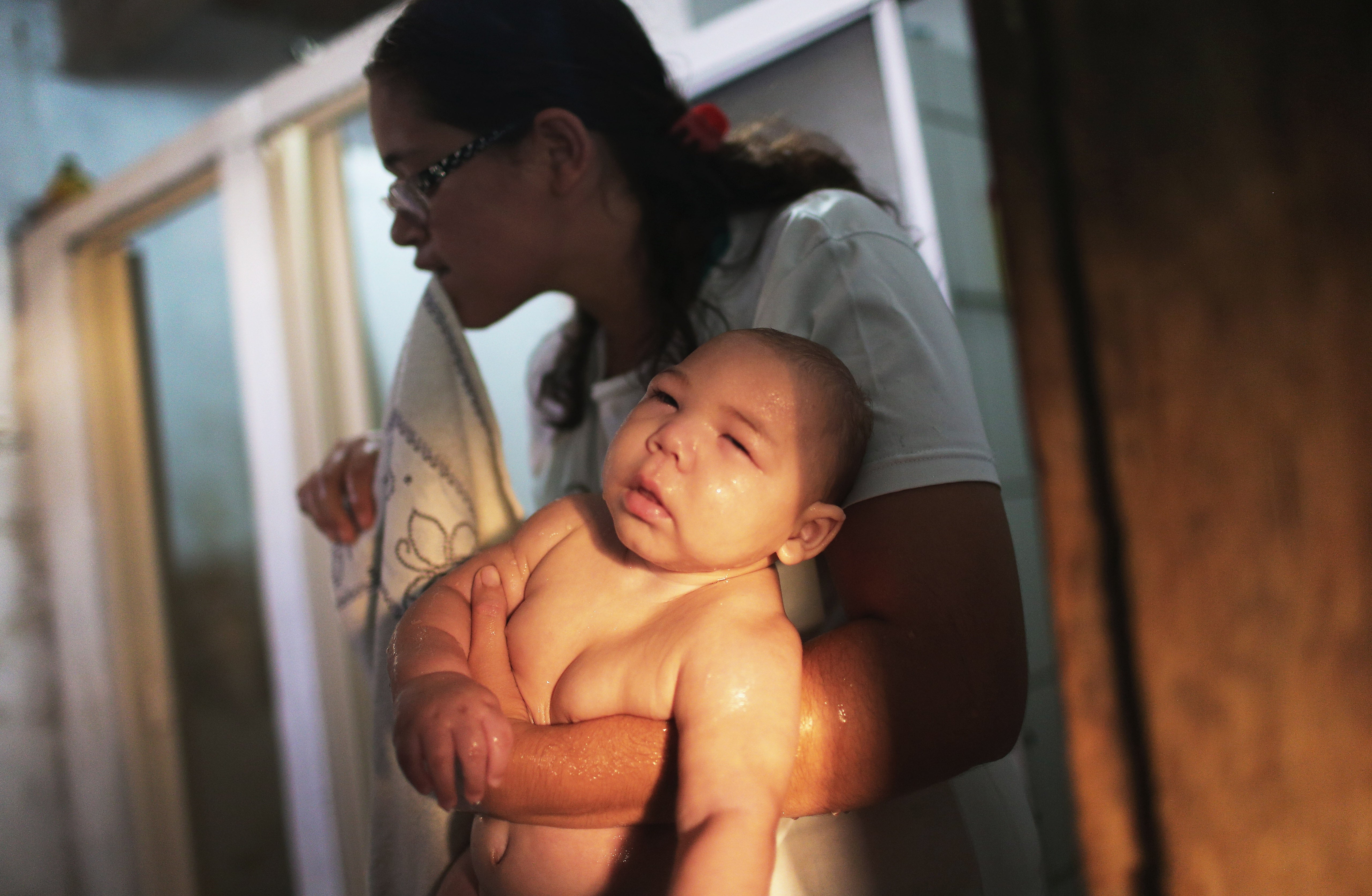 &#13;
A five-months-old baby, who has microcephaly, on 25 January 2016 in Recife, Brazil.&#13;