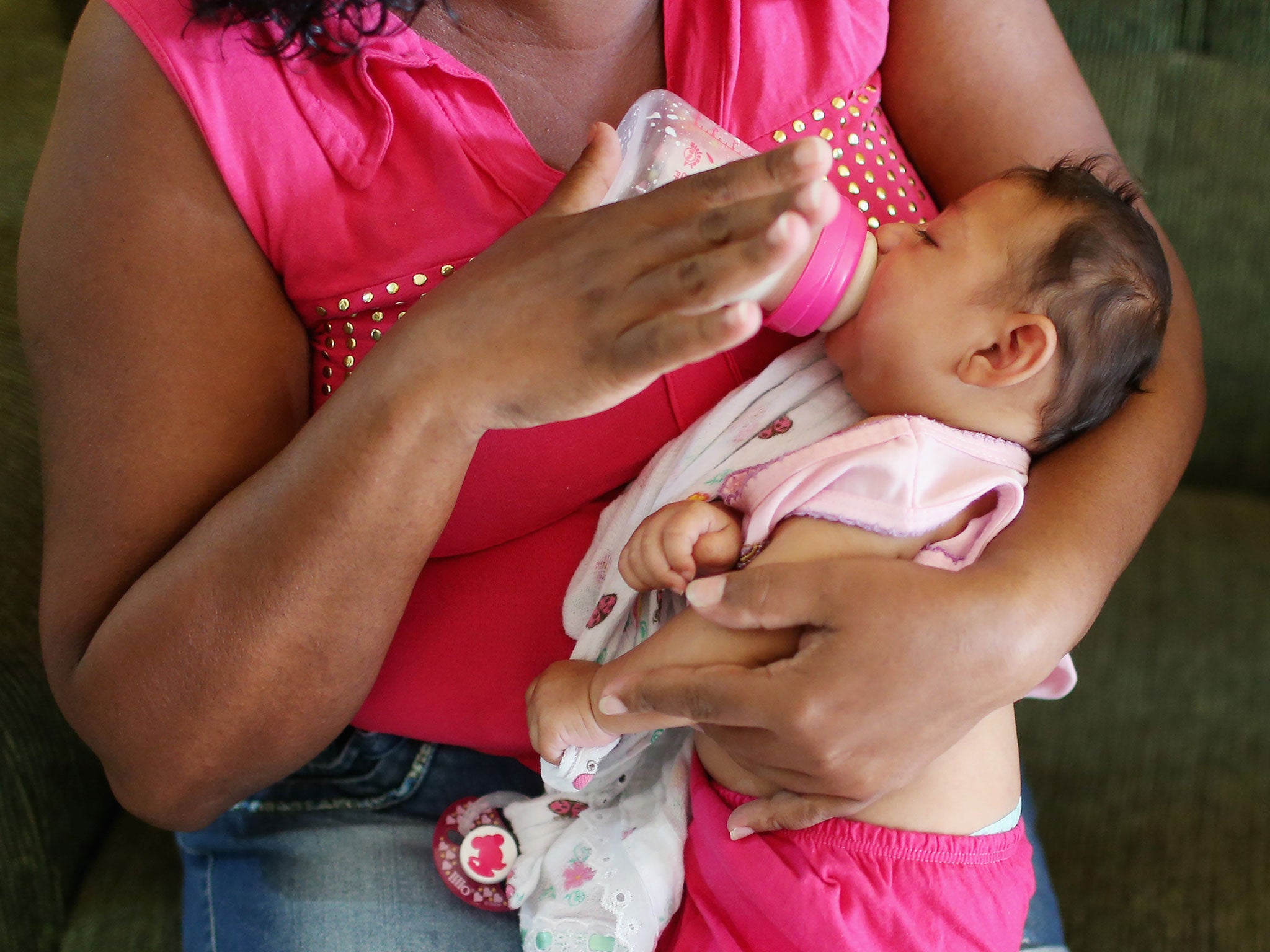 A three-month-old with microcephaly in Recife, Brazil. (Getty)