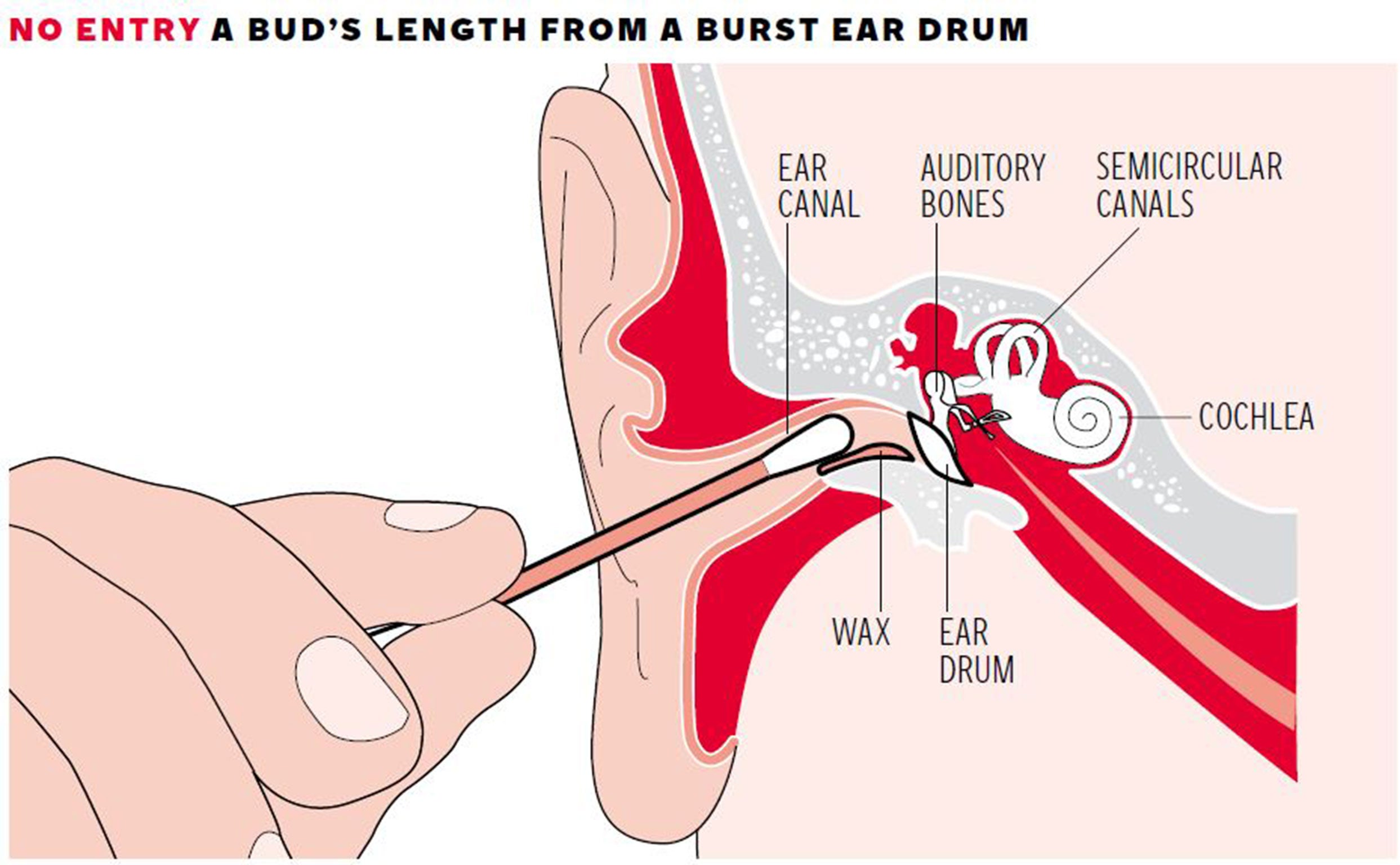 The ear canal leads to a number of sensitive bones and organs which can be harmed by interference