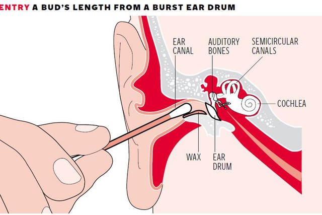 The ear canal leads to a number of sensitive bones and organs which can be harmed by interference