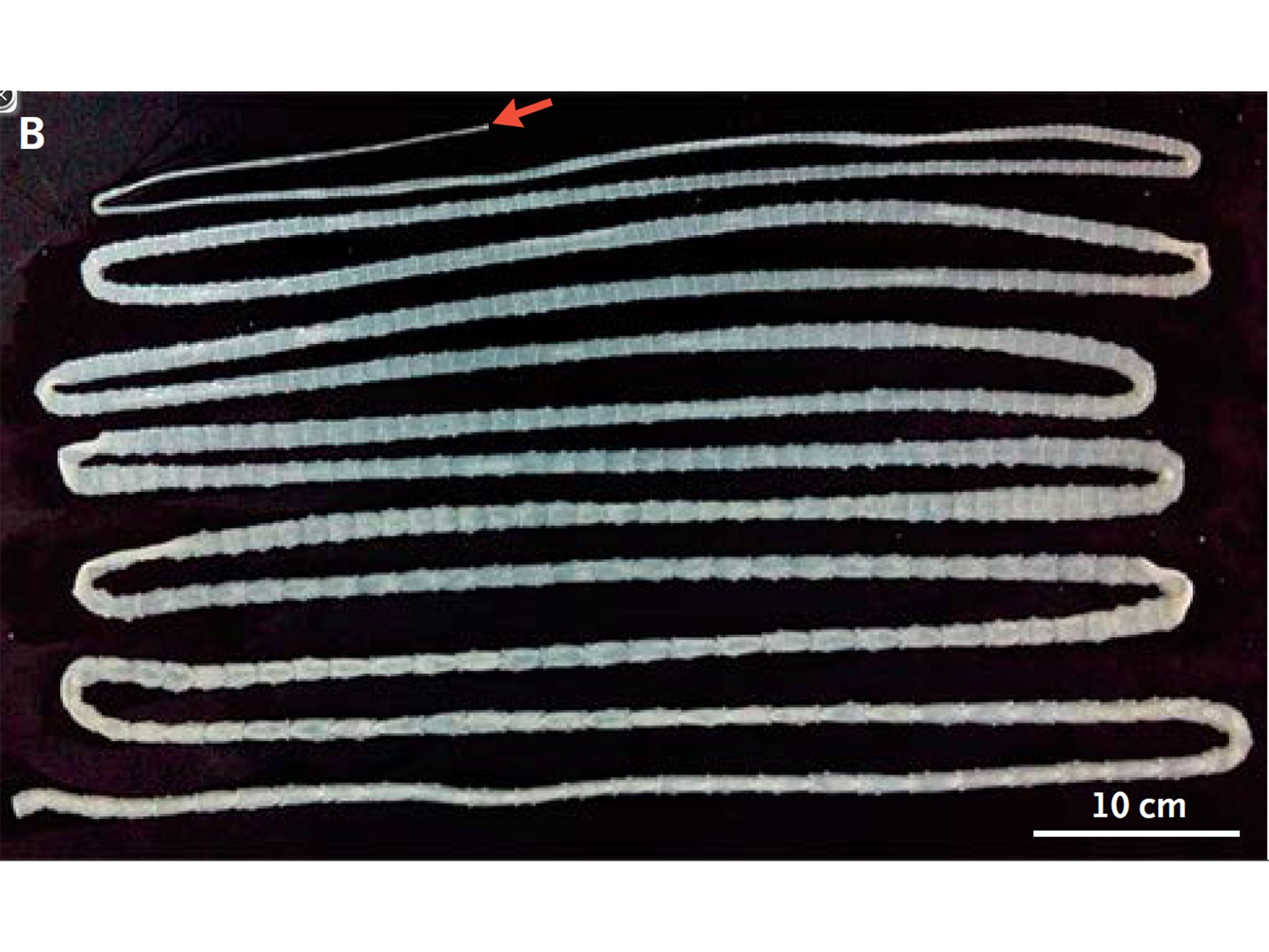 Taenia Tapeworm Segment