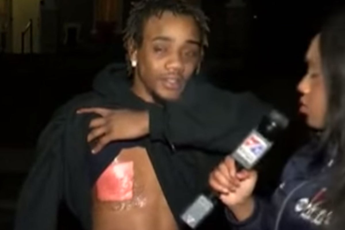 Man gives live TV interview right after being shot | The Independent ...