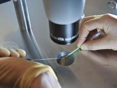 Read more

Fertility treatments that are ‘widely discredited’ or ‘hotly debated’