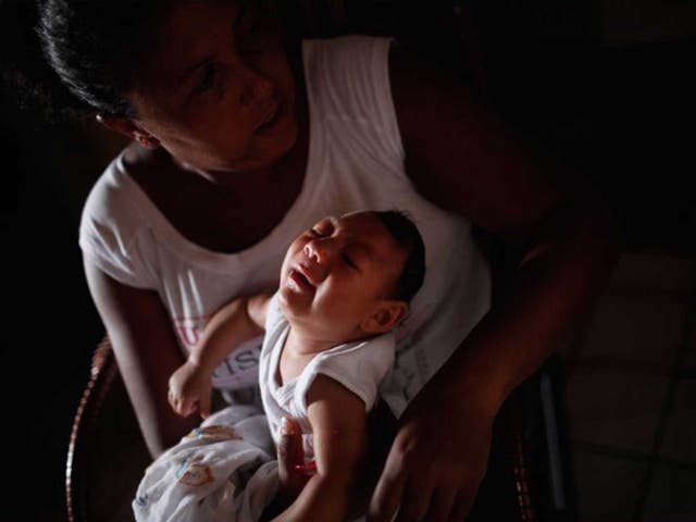 A baby born with microcephaly, in Recife, Brazil. The condition has been linked to the Zika virus, transmitted by mosquitoes