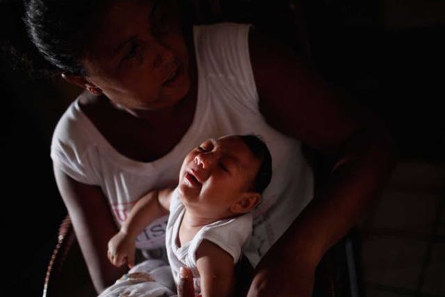 A baby born with microcephaly, in Recife, Brazil. The condition has been linked to the Zika virus, transmitted by mosquitoes