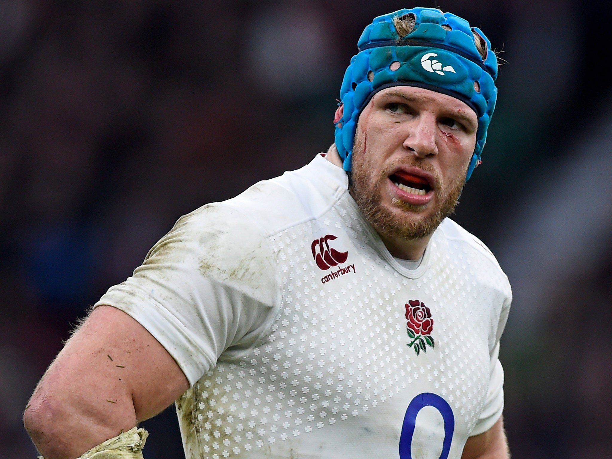 James Haskell could be out of action for the rest of the year