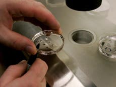 Human cells grown in sheep embryos in organ donation breakthrough