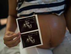 Pregnant women 'begging online for abortion pills' due to Zika fears