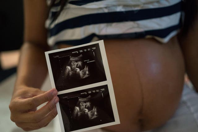Woman who is six months pregnant, shows a photo of her ultrasound at the IMIP hospital in Recife, Pernambuco state, Brazil