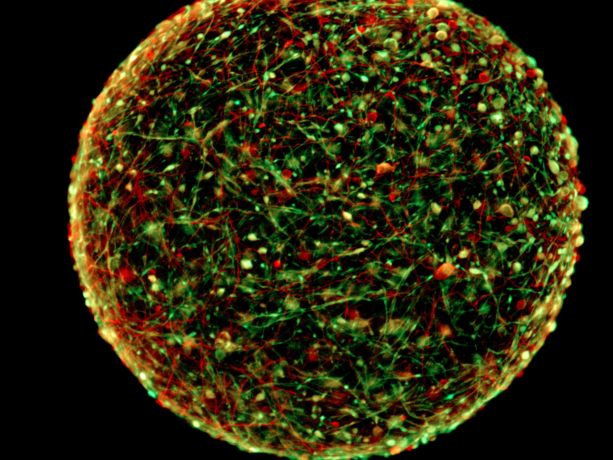 A magnified image of one of the ‘mini brains’, which it is hoped will aid research into neurological diseases