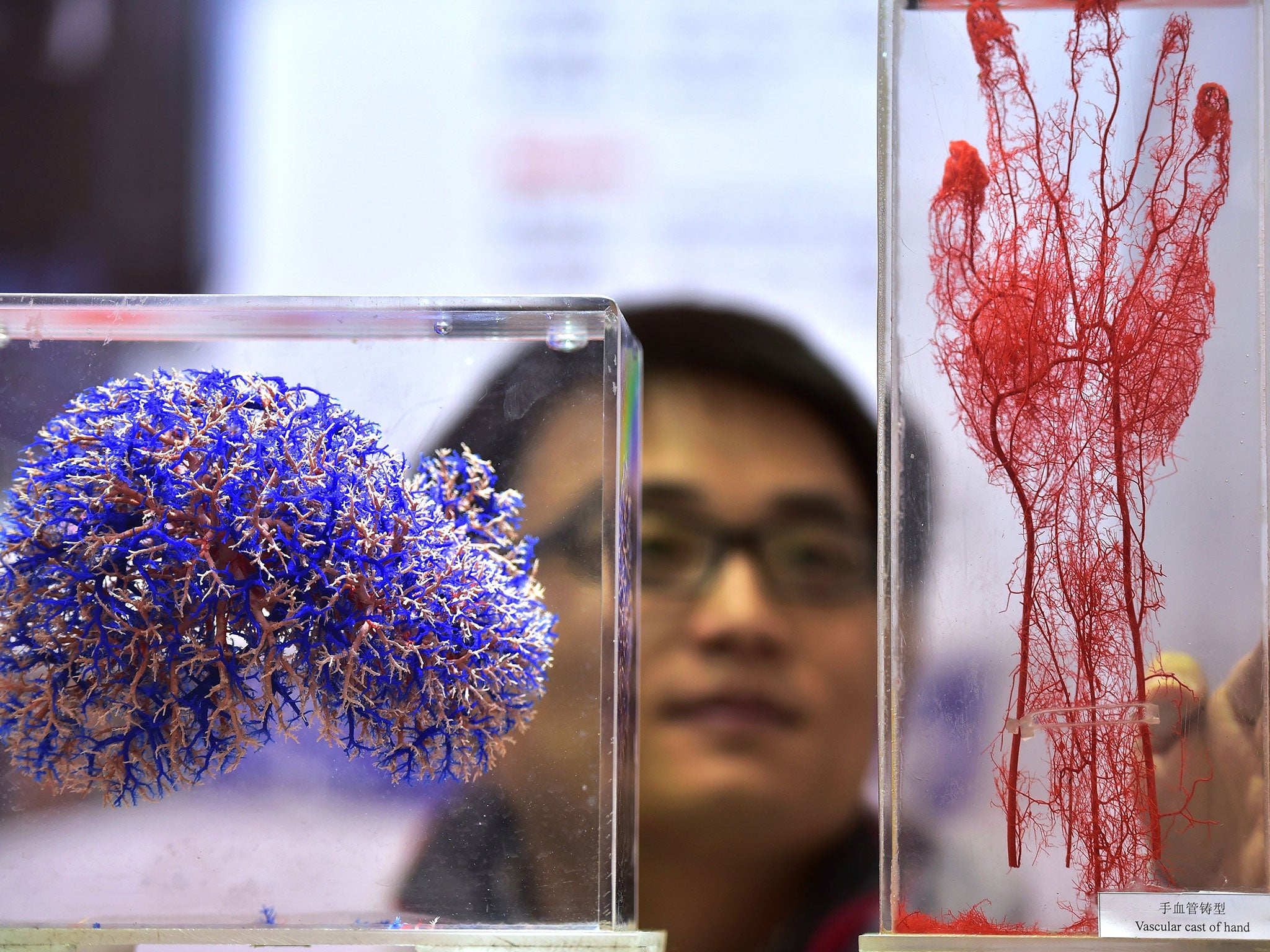 New technologies will soon make it able to print living tissue, cartilage and bone