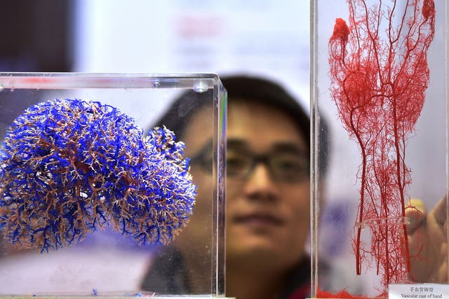 New technologies will soon make it able to print living tissue, cartilage and bone