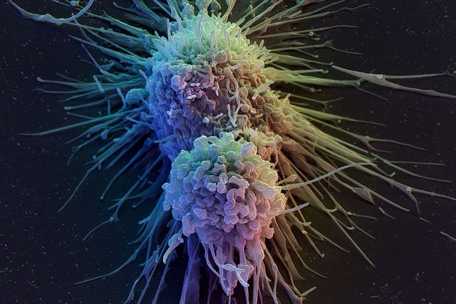 Lymphoblast cells eventually become lymphocytes, cells that are responsible for fighting infection, such as T-Cells
