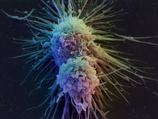 Read more

'Extraordinary' new cancer drug offers prospect of lasting cure