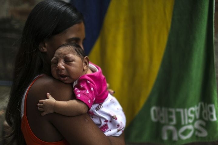 A mother holds her daughter who was born with microcephaly