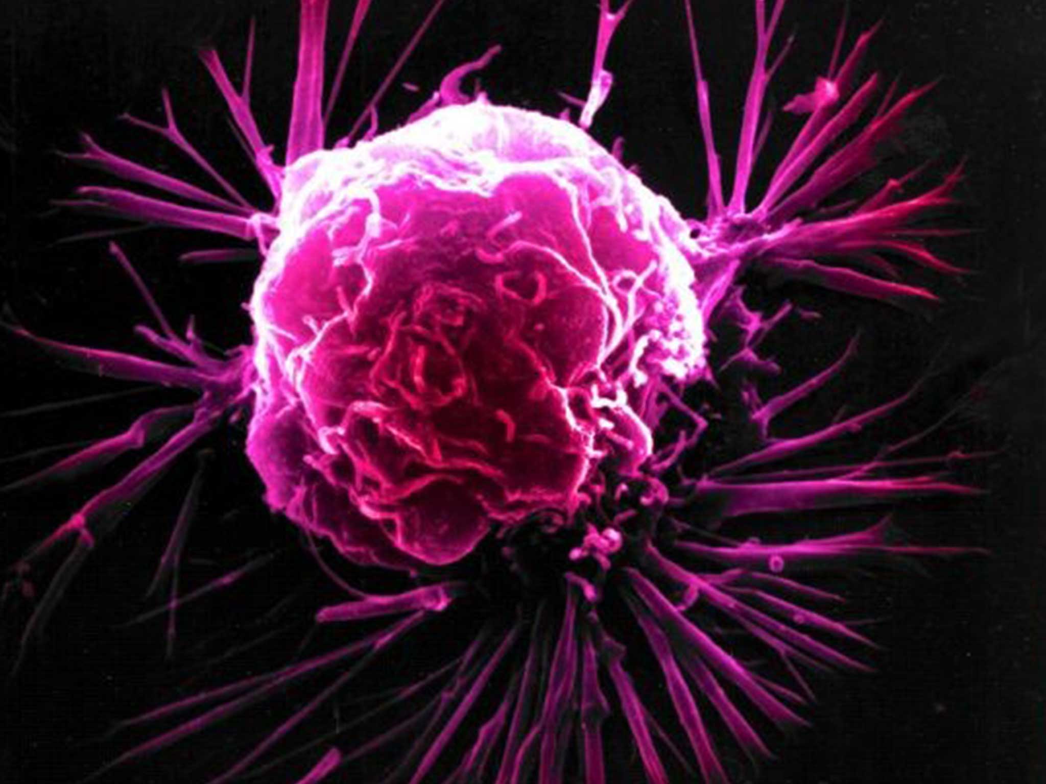 The new study drives home an important point that scientists already know how to prevent a large swath of cancer deaths