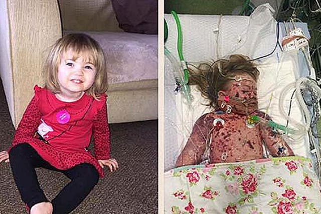 Two-year-old Faye Burdett fought meningitis for 11 days before her death