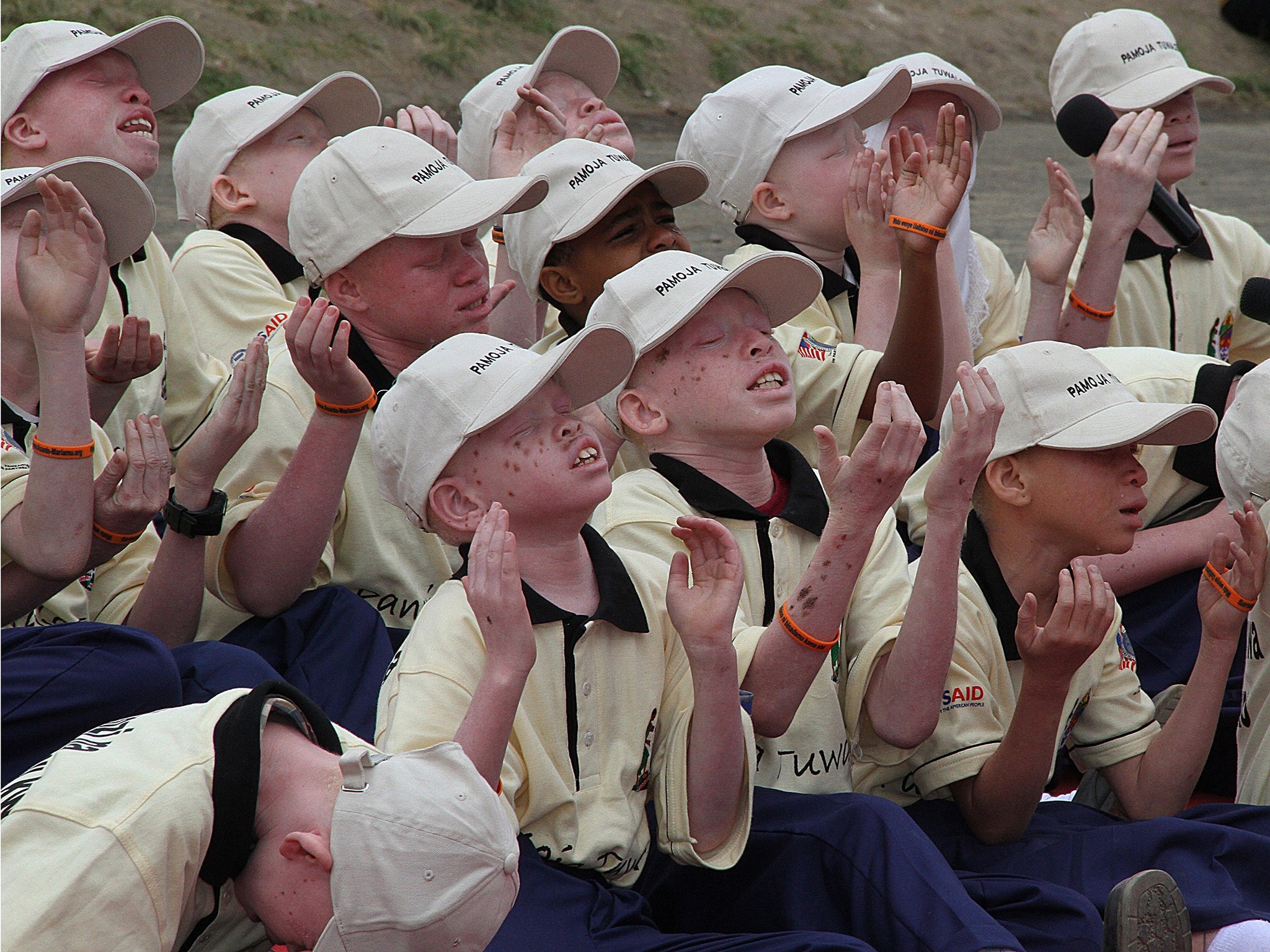 Young children with albinism in Tanzania (file photo)
