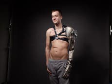 Prosthetics: Amputee James Young unveils hi-tech synthetic arm inspired by Metal Gear Solid