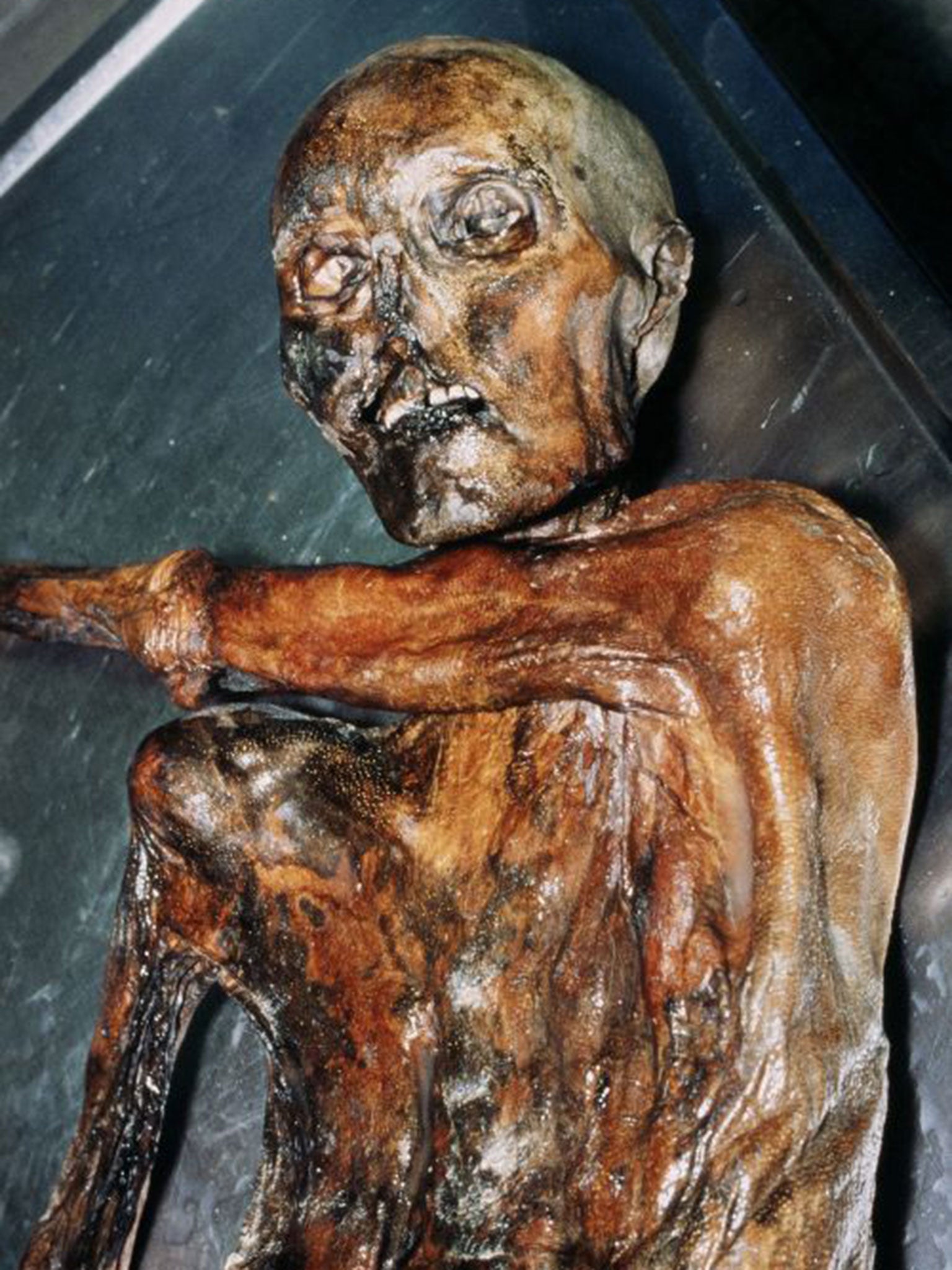 The discovery of Ötzi in the Italian Alps in 1991 provided information about life in the Neolithic period