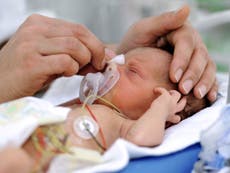 Premature birth therapy ‘ineffective’, says study