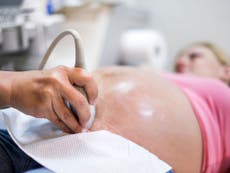 What happens to your brain when you’re pregnant?