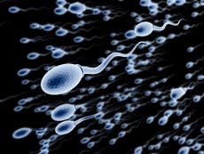 Read more

Infertile men ‘could grow new sperm from skin cells’