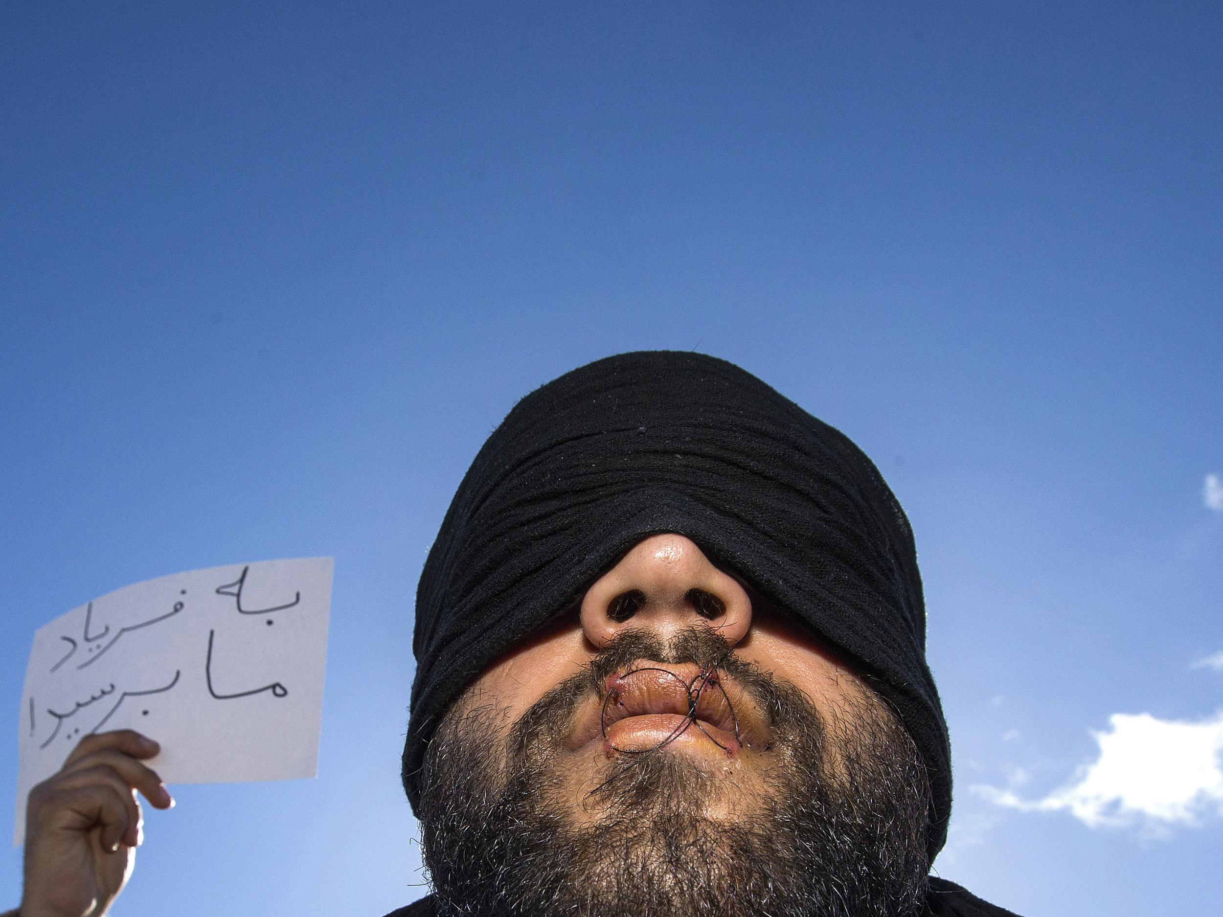 A placard reading " Why don't you listen to us" is seen behind a Iranian migrant, his lips sewn shut and making an hunger strike, during the dismantlement of the shanty town called the "Jungle" in Calais, France.