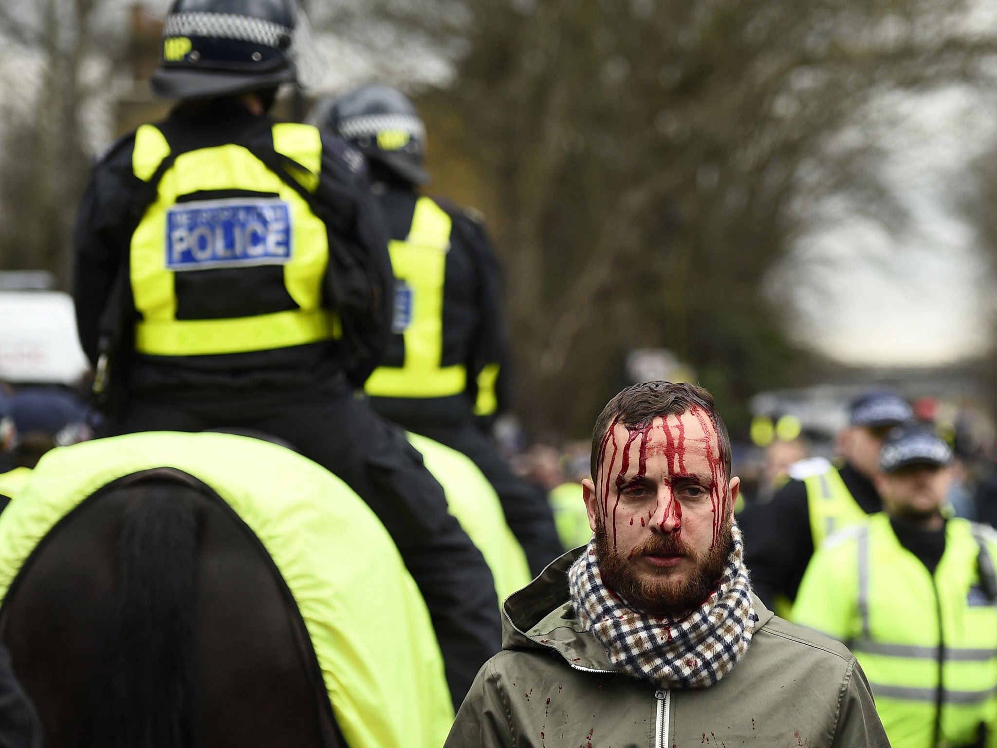 A fan is seen with blood streaming down his face