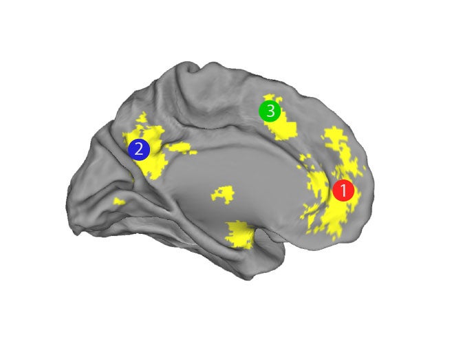 The three regions of the brain which were analysed for connectivity with self-disclosure on Facebook (Pic: Freie Universität Berlin)