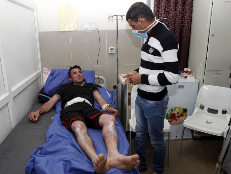 A man lies in a hospital following the in Taza, Iraq