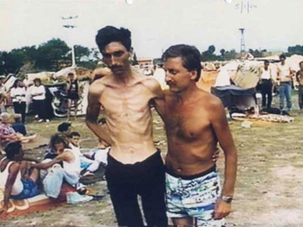 Inmates at Trnopolje camp