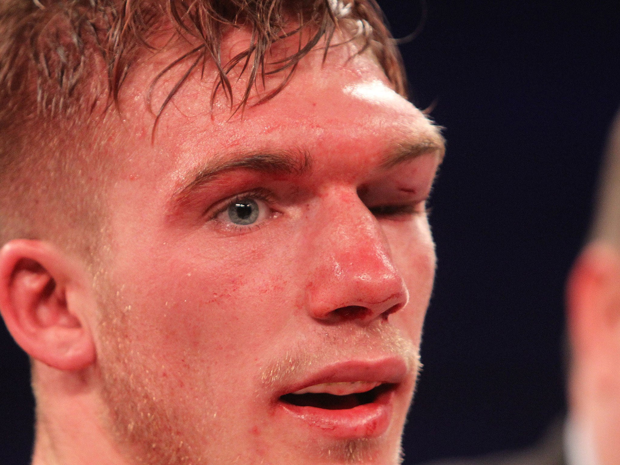 &#13;
The bout was stopped in the tenth round when Blackwell couldn't see out his left eye?(TGSPhoto/Rex Features)&#13;