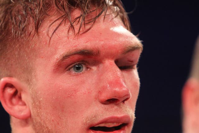 Nick Blackwell's eye injury during his fight with Chris Eubank Jnr