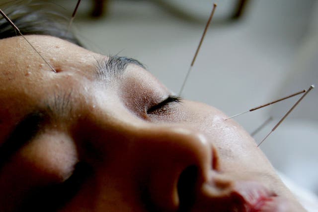 Previous trials have found acupuncture in the ears and other pressure points improved IVF birth rates