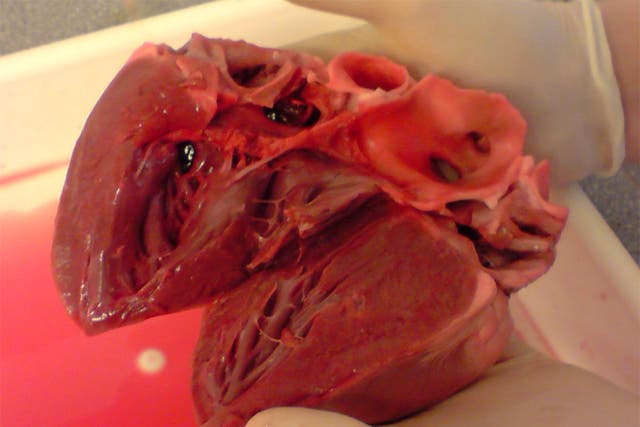 Pig hearts are anatomically similar to ours and less risky than primate transplants
